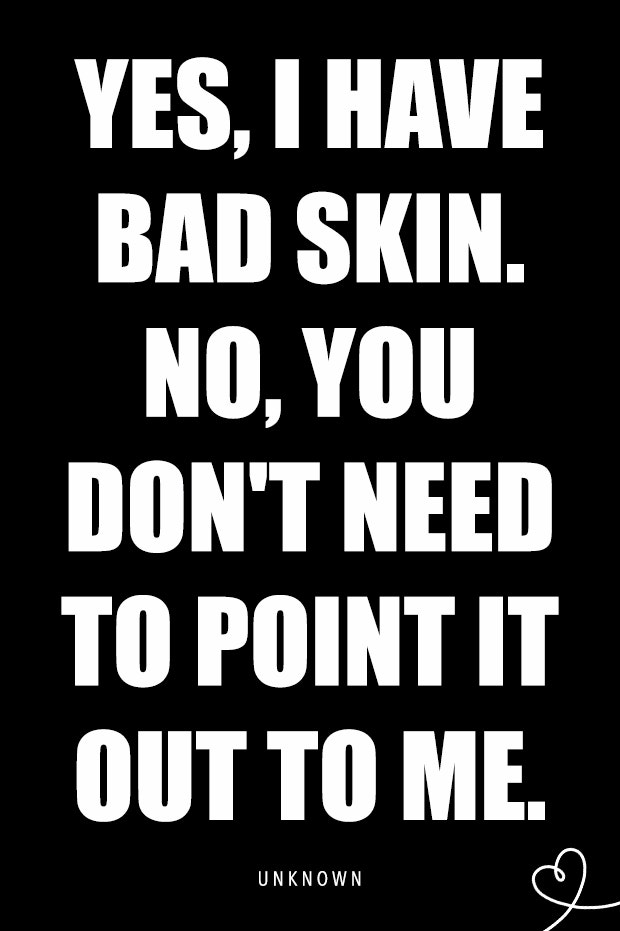 relatable quotes about acne memes pimple quote